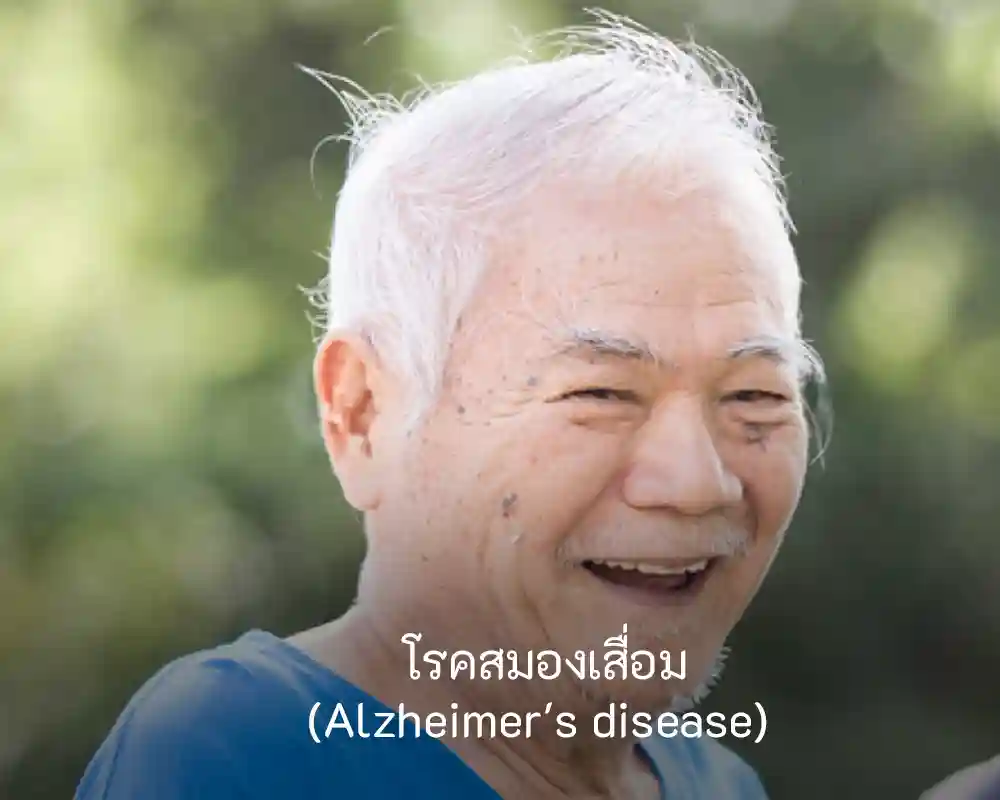 Alzheimer-disabilities