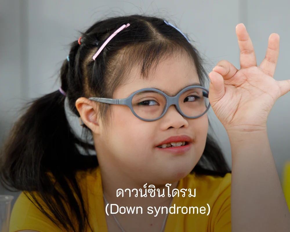 down-syndrome-disabilities